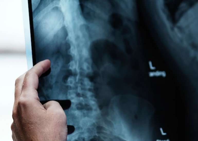 X-Ray: Imaging Tests For Clinical Diagnosis