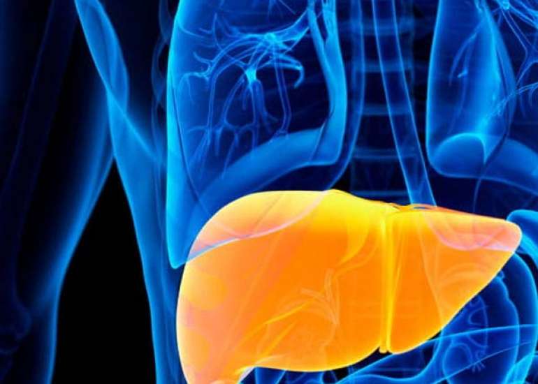 Impact of Fatty Liver Disease on Cardiovascular Health: Understanding the Connection