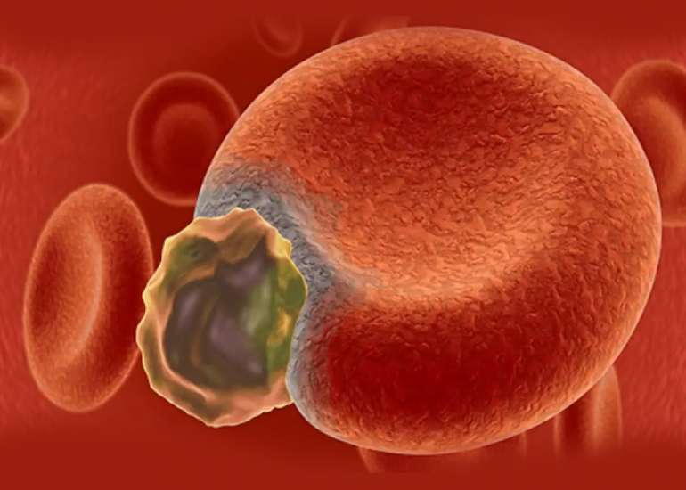 What are the important points to be considered in sepsis and septic shock?