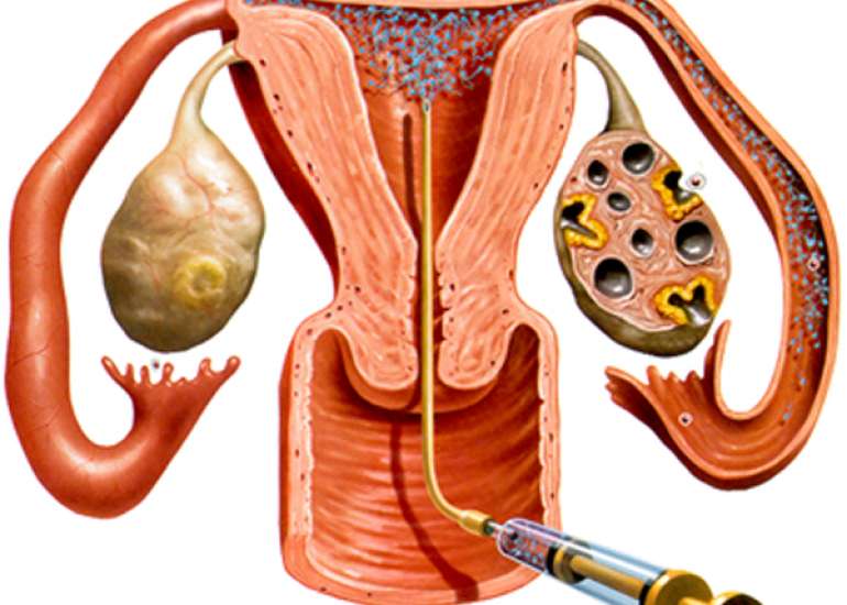 How do we induce ovulation?