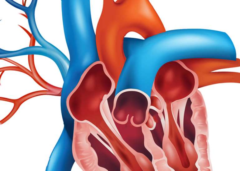 What are the guidelines for interventing mitral stenosis?