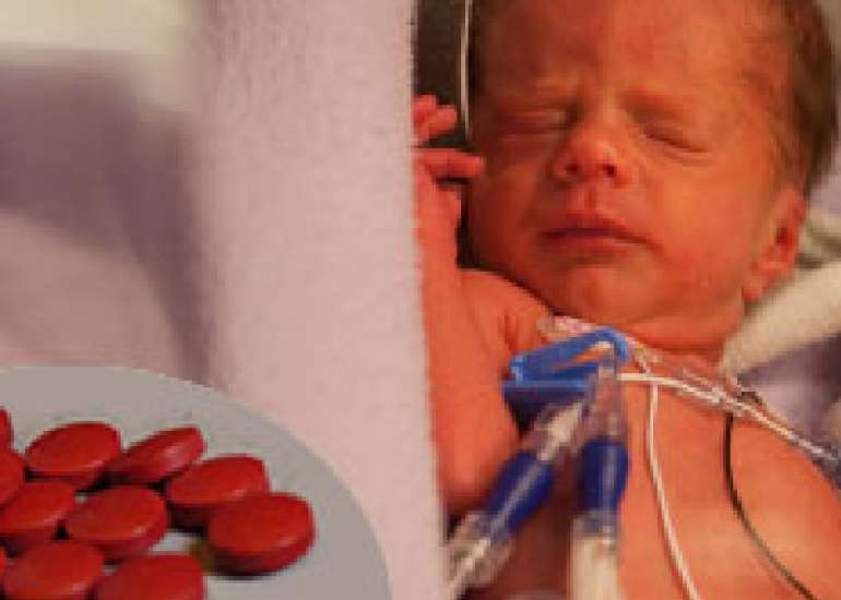 Iron and Neurodevelopment in Preterm Infants