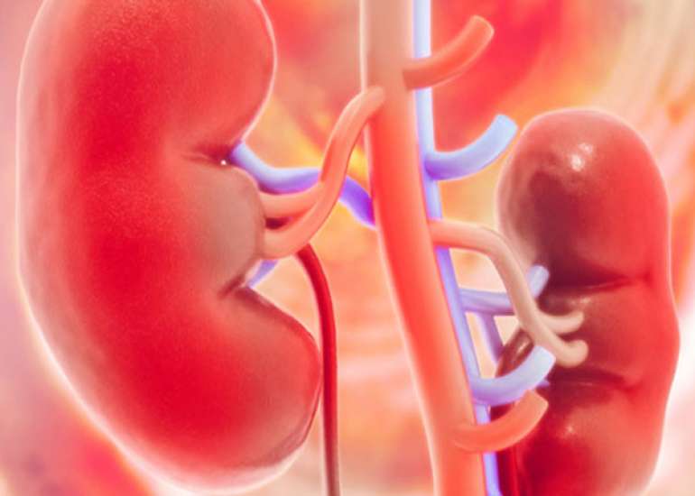 If the GFR is less than 60, How should we manage the patient?