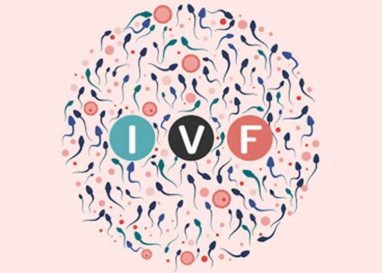 कैसे किया जाता है आईवीएफ़ ट्रीटमेंट प्रोसेस