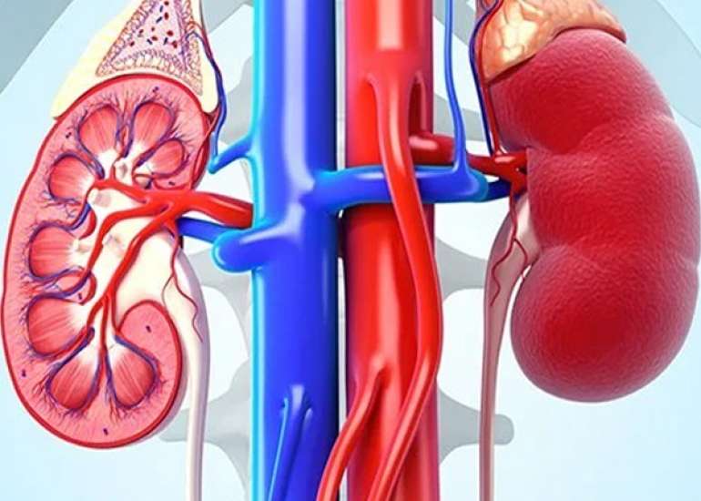 रीनल एजेनेसिस क्या है? लक्षण, कारण और उपचार | Bilateral Renal Agenesis in Hindi