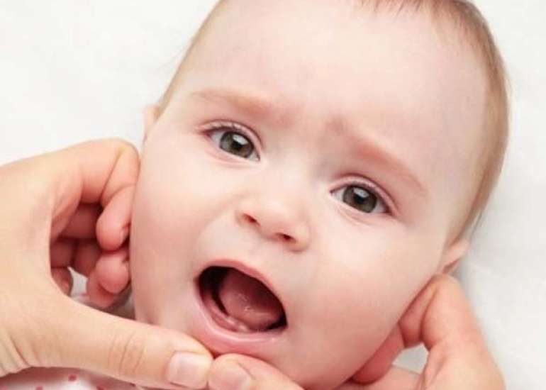 बच्चों के दांत निकलने पर क्या होती है समस्याएँ? | Medtalks