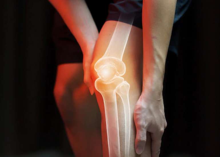 क्यों होता है घुटने का एक्स-रे? Knee X-ray in Hindi