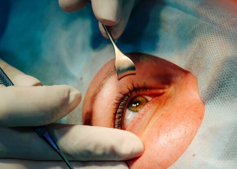 लेसिक नेत्र शल्य चिकित्सा क्या है? विस्तार से जाने | Lasik Eye Surgery in Hindi