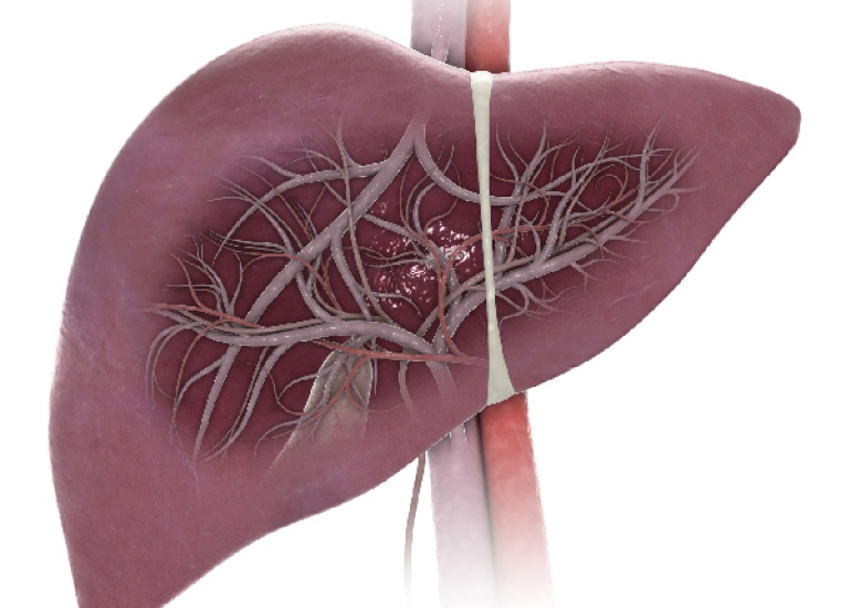 लिवर एंजाइम असामान्यताएं: उन्नत एसजीओटी और एसजीपीटी के महत्व की पहचान