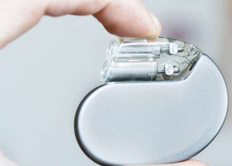 What does a pacemaker look like?