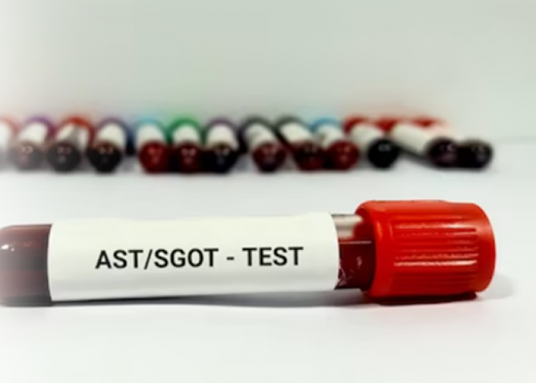 आहार और व्यायाम के माध्यम से एसजीओटी और एसजीपीटी स्तर को स्वाभाविक रूप से कम करें