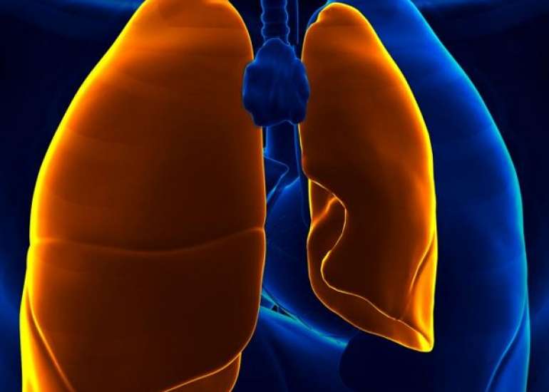 न्यूमोथोरैक्स क्या है? कारण, लक्षण, इलाज और बचाव | Pneumothorax in Hindi