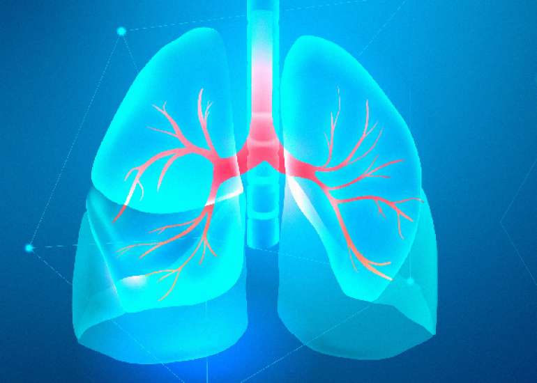 निमोनिया कितना गंभीर? कारण, लक्षण और इलाज | Pneumonia in Hindi