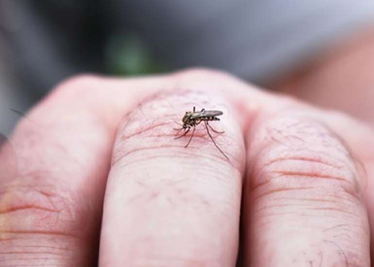 How should we manage a patient with Dengue Fever?