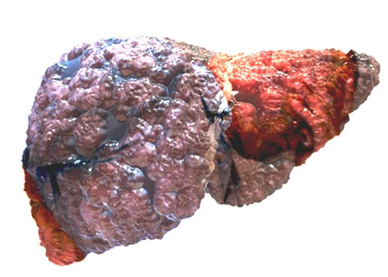 Managing Liver Disorders in the Geriatric Patient