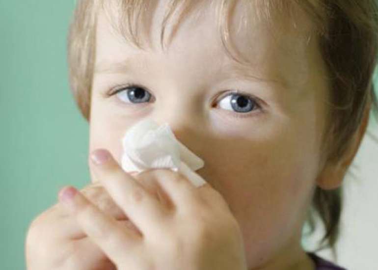 Is there any connection between Nasal congestion and severe asthma?