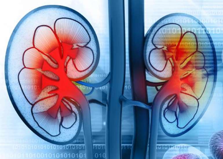 What medication are needed in patients with CKD?