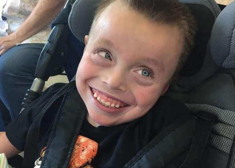 मेनकेस रोग क्या है? कारण, लक्षण और इलाज | Menkes Disease in Hindi