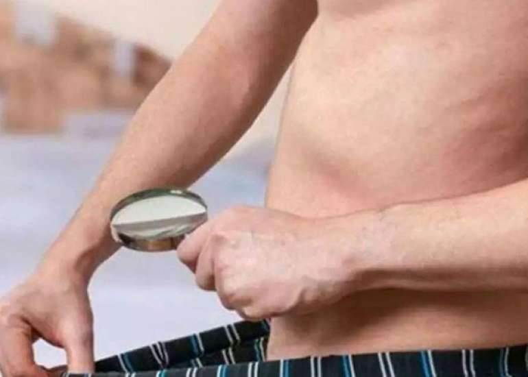 माइक्रोपेनिस क्या है? कारण, लक्षण और इलाज | Micropenis in Hindi
