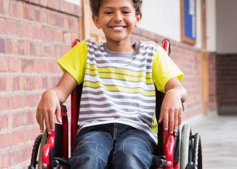 मस्कुलर डिस्ट्रॉफी क्या है? कारण, लक्षण और इलाज | Muscular Dystrophy in Hindi