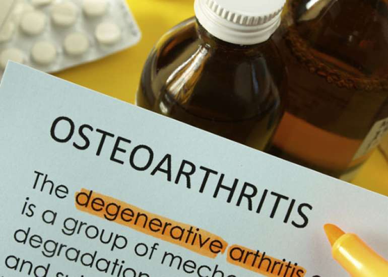 What is the medical management of osteoarthritis?