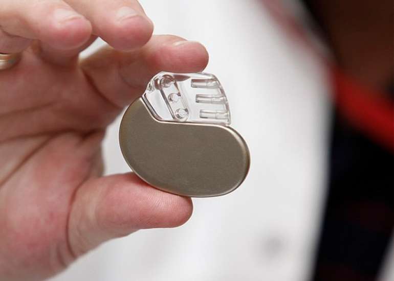 What are the different types of pacemakers and when are they necessary?