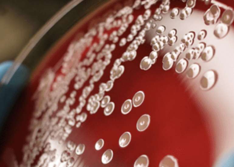 What is the need for sepsis code?