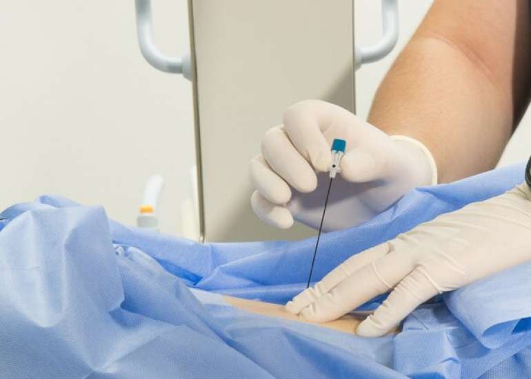 तंत्रिका ब्लॉक क्या है? | Nerve Block in Hindi