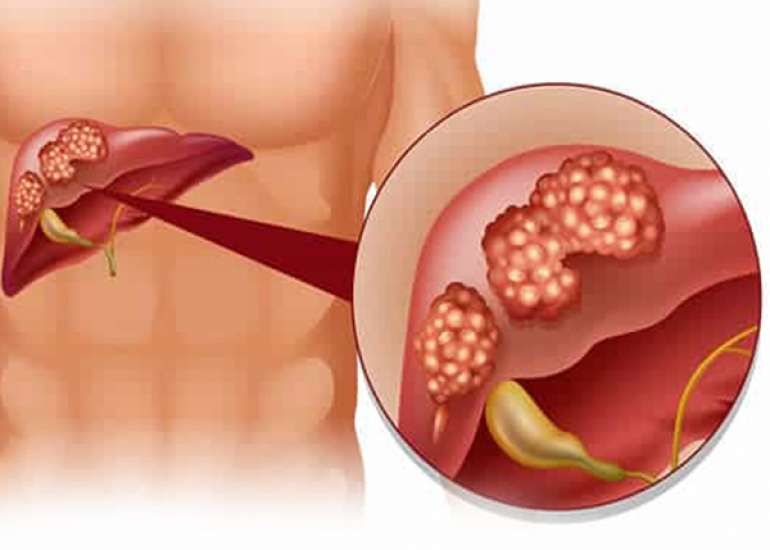 What is the normal range of SGOT and SGPT
