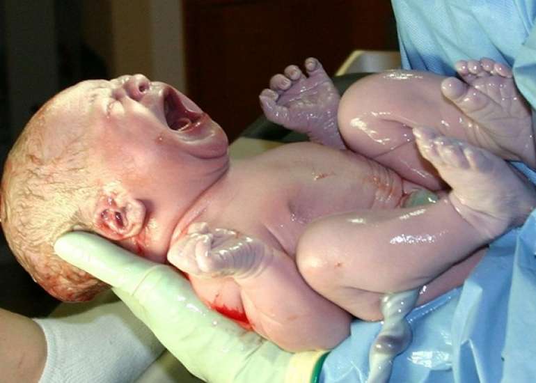 नवजात संयम सिंड्रोम (NAS) – कारण, लक्षण और बचाव | Neonatal Abstinence Syndrome in Hindi