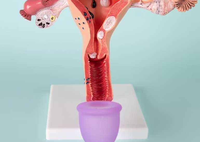 ओलिगोमेनोरिया क्या है? कारण, लक्षण और इलाज | Symptoms, Causes, Diagnosis, Treatment