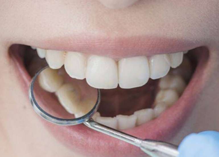 डेंटल और ओरल हेल्थ के बारे में सब जाने | Medtalks