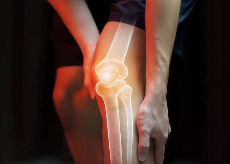 ऑस्टियोपोरोसिस क्या है? कारण, लक्षण और इलाज | Osteoporosis in Hindi