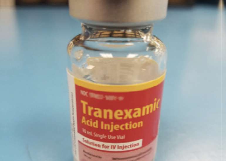 Study confirms efficacy of tranexamic acid in PPH management