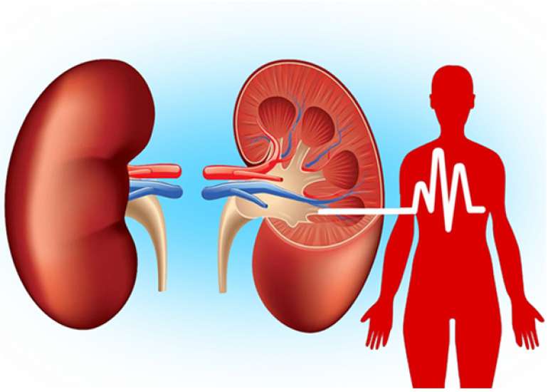 I have CKD and hypertension - Can pain killers worsen my condition?