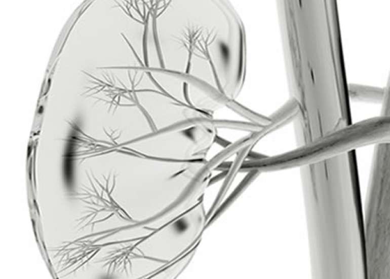 पेरीनोप्लास्टी क्या है? | Perineoplasty in Hindi