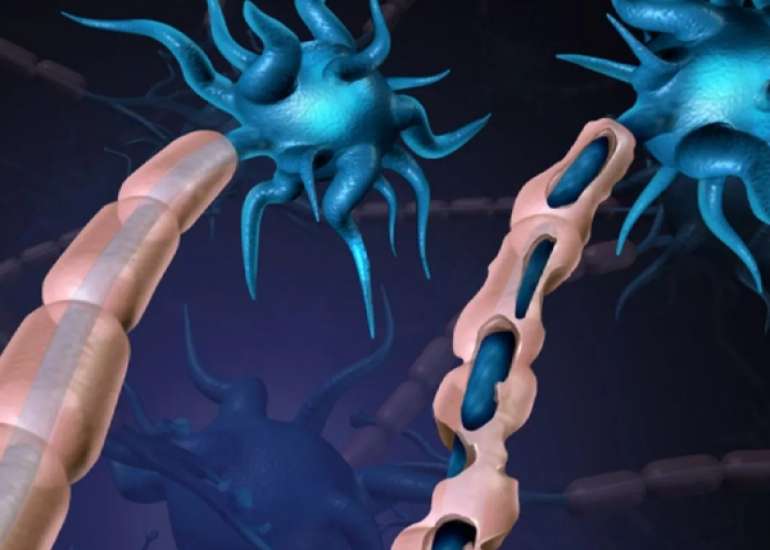 Peripheral Nerve Injury - Neuropraxia: All You Must Know