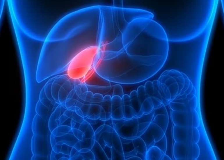 पित्त का कैंसर, दुर्लभ लेकिन गंभीर – कारण, लक्षण, और उपचार | Gallbladder Cancer in Hindi