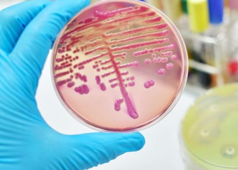 What are the important points to be considered in sepsis and septic shock?