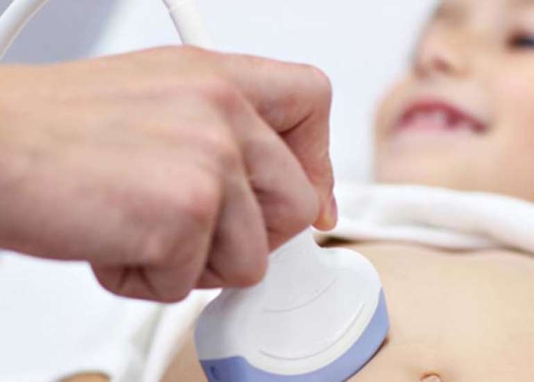 Point-of-Care Ultrasound for Assessing Fluid Responsiveness in Children with Shock