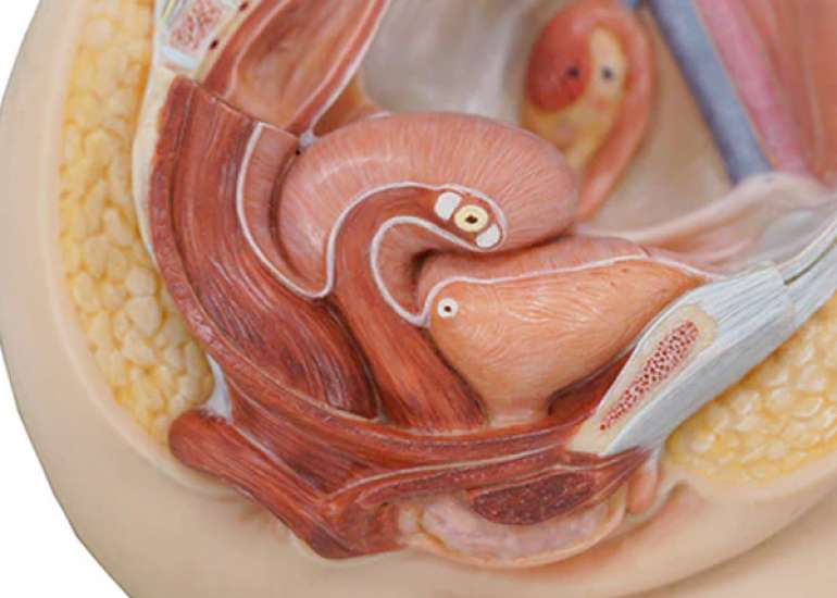 Posterior Vaginal Prolapse (Rectocele): An Overview