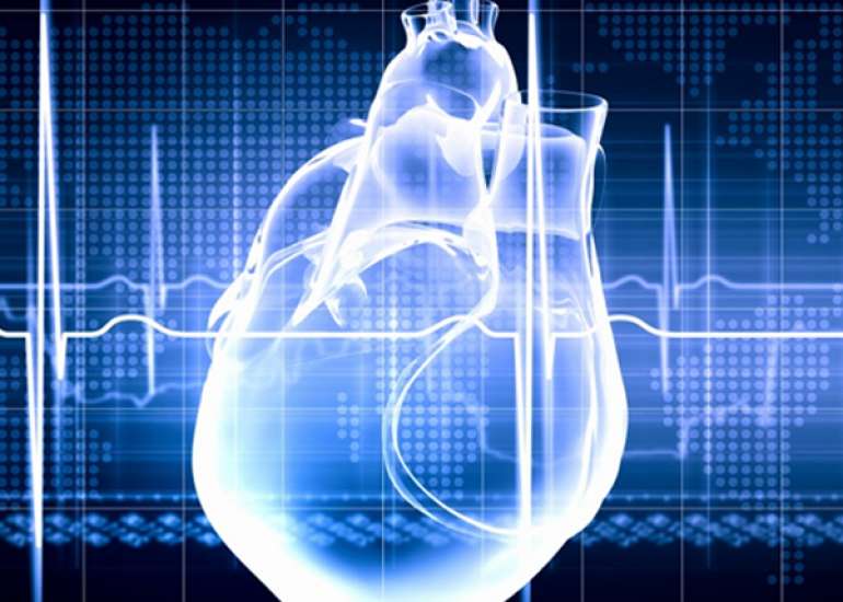 What is the role of prasugrel in acute MI?