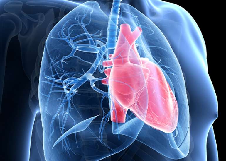 Pulmonary Hypertension: Clinical Manifestations and Management