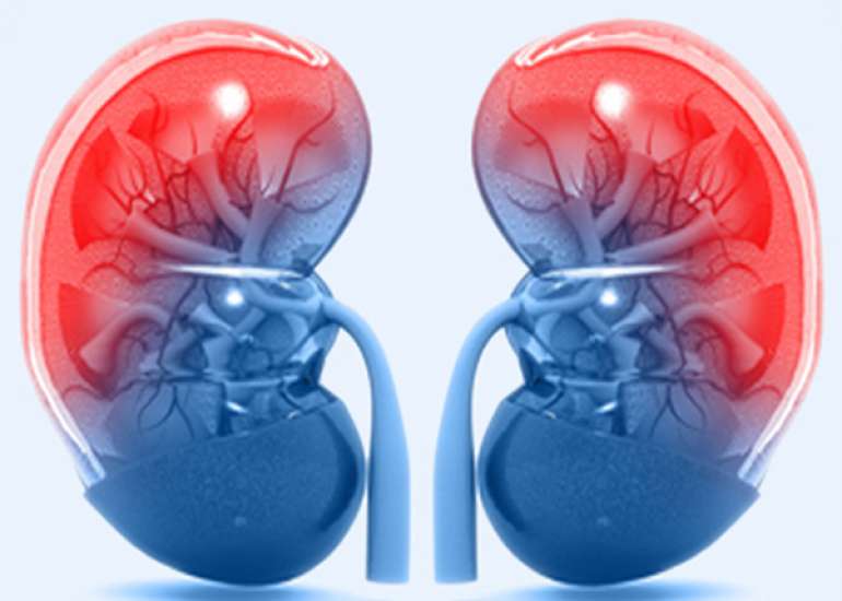 How should we manage the patient who has reached CKD 5?