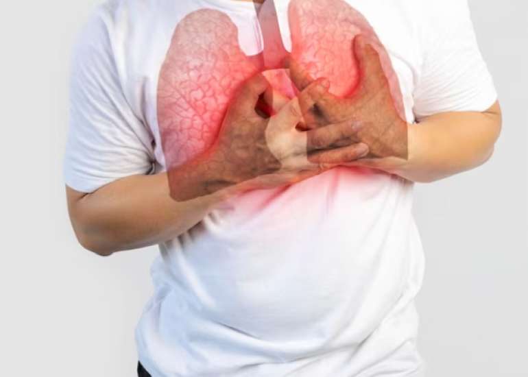 फेफड़े के दुर्लभ रोग क्या हैं? | Rare Lung Disease in Hindi