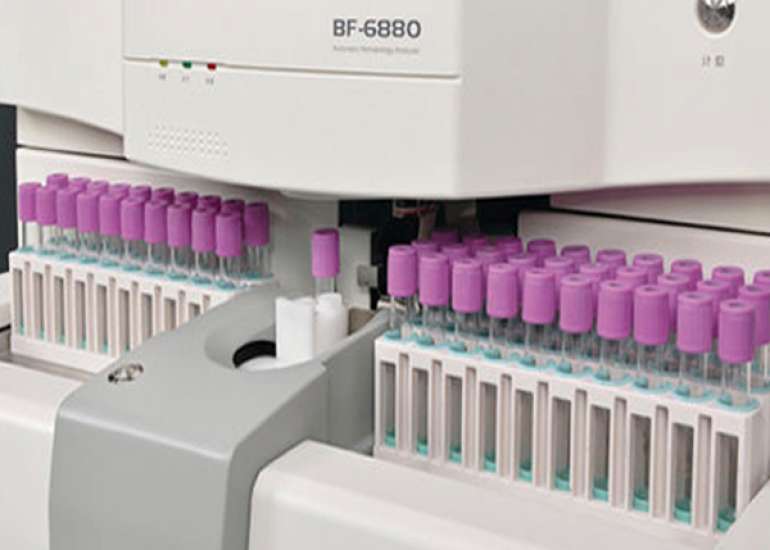 How reliable are hematology reports by automatic analyzers?