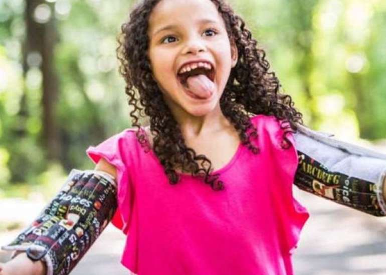 रेट सिंड्रोम क्या है? कारण, लक्षण और उपचार | Rett Syndrome in Hindi