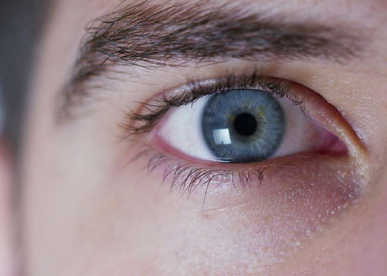 What are the risk factors of glaucoma?