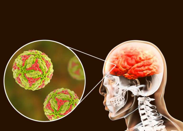 Should every case of encephalitis be treated?