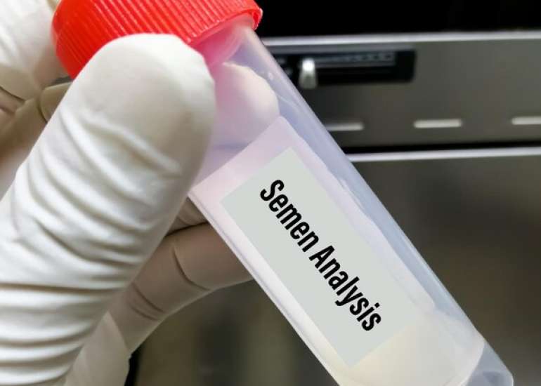 वीर्य जांच क्यों आवश्यक है?| Semen Analysis in Hindi